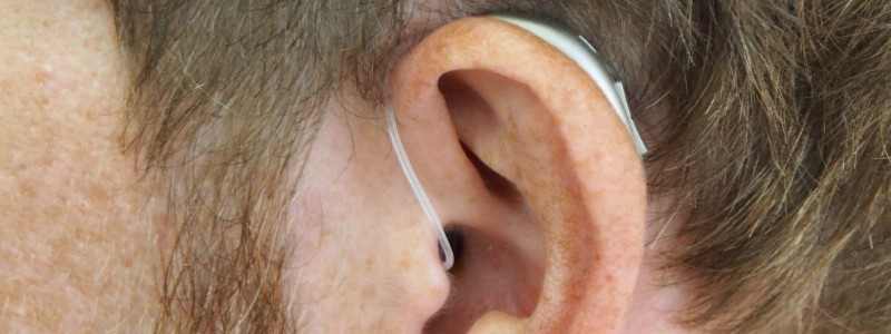 Bilateral hearing loss